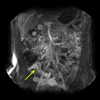 <a href="../../papers_abstracts/abstracts/110.html">DCE-MRI-oriented Volume Rendering for Monitoring of Crohn's Disease</a>