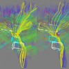 <a href="../../papers_abstracts/abstracts/140.html">InBox: In-situ Multiple-Selection and Multiple-View Exploration of Diffusion tensor MRI Visualization</a>