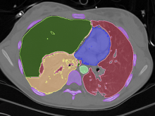 User-guided Segmentation of Thoracic Computed Tomography Data for Electrical Impedance Tomography Image Reconstruction