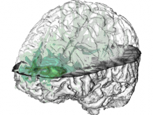 Tractography in Context: Multimodal Visualization of Probabilistic Tractograms in Anatomical Context